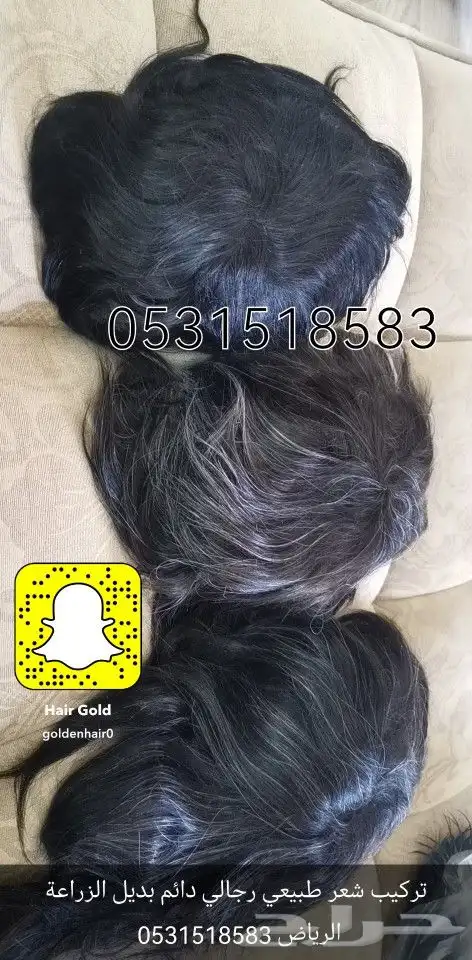 وداعا للصلع ووداعا للزراعة الحل الافضل 18