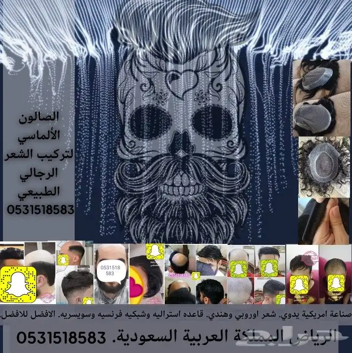 شعر بشري طبيعي لصق بديل الزراعة 8