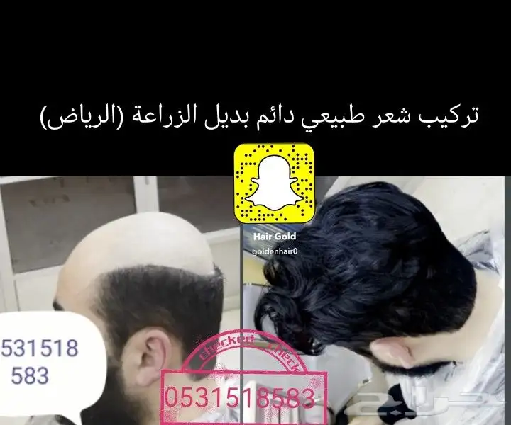 شعر بشري طبيعي لصق بديل الزراعة 14
