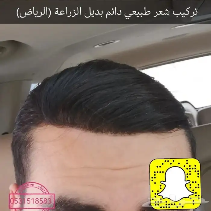 تركيب شعر لصق امريكي 14