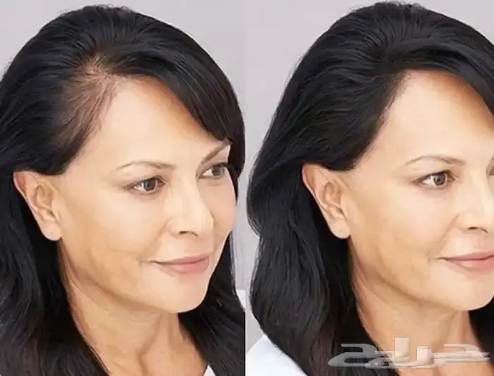 Toppik توبيك بودرة الشعر للصلع و الفراغ والفر 4