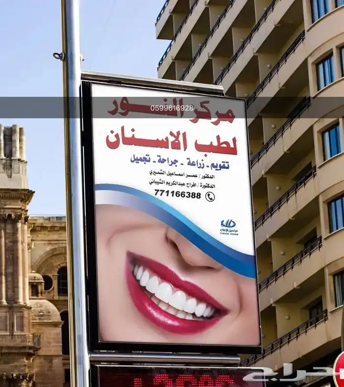 تسوير مشاريع بنر 9