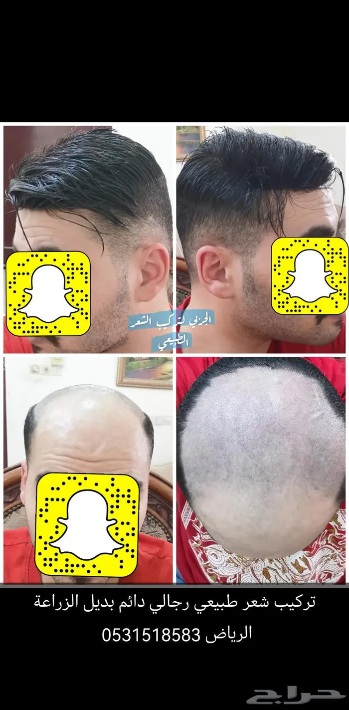 باروكة تركيب شعر طبيعي دائم 6