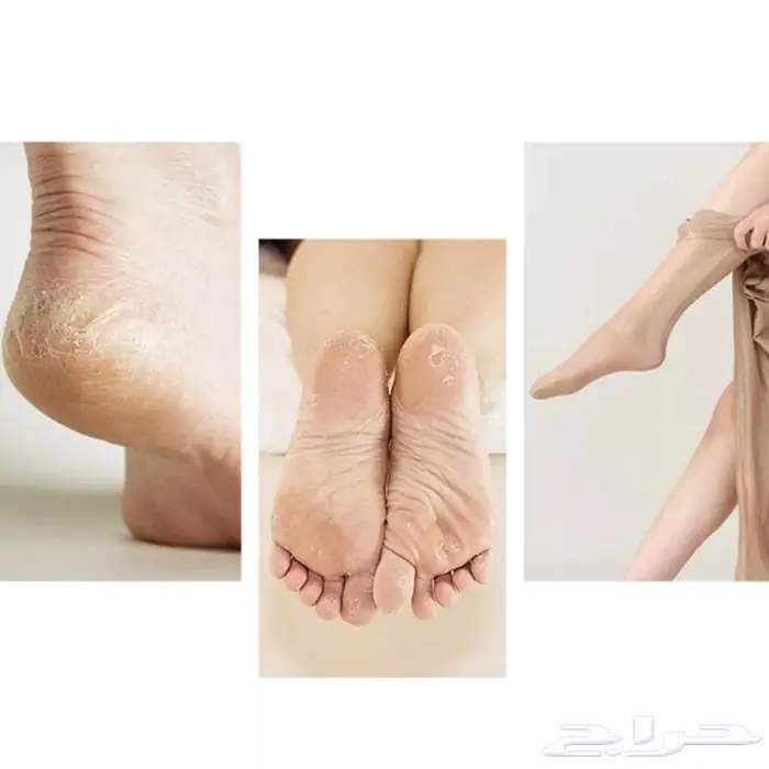 جهاز قدمين 2