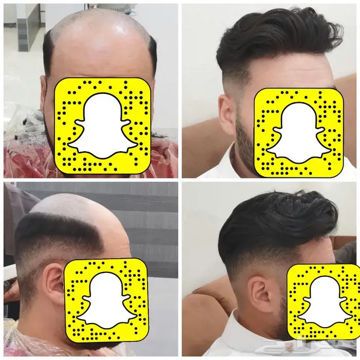 بواريك بوستيجات اصليه للصلع 0