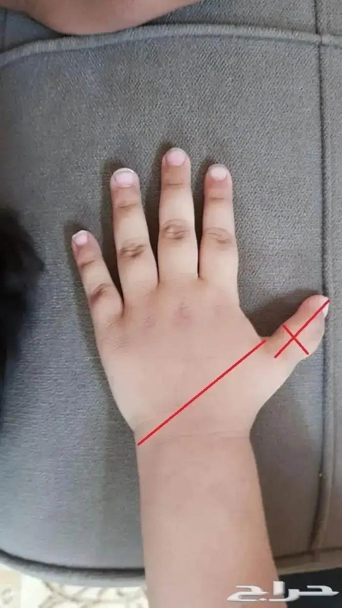 مانع مص الاصبع للاطفال منتج امريكي 3