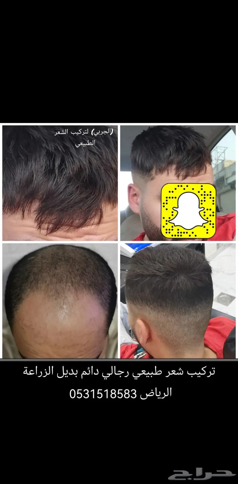 باروكة انجليزي واوروبي 7