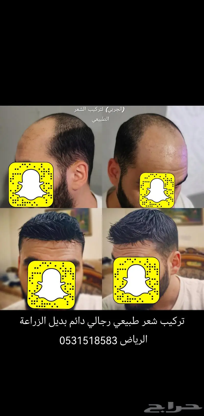 بواريك تركيب انجليزي واوروبي 7