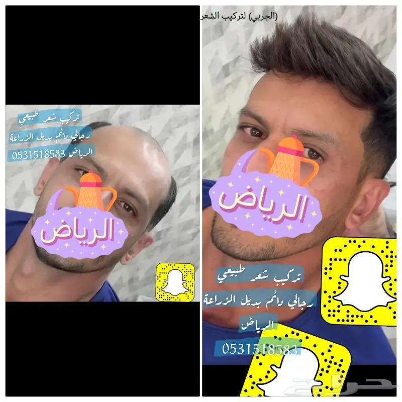 باروكة انجليزي واوروبي 8