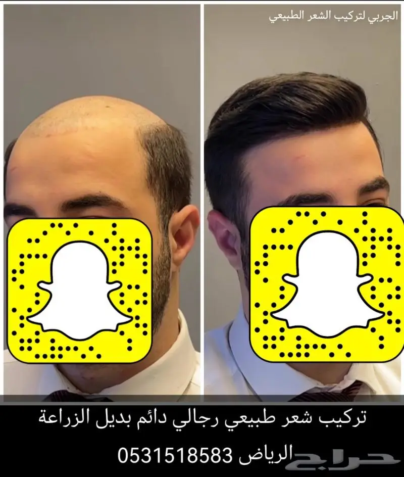 باروكة انجليزي واوروبي 4