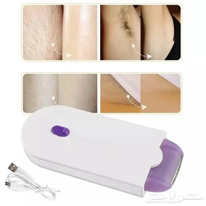 بوكس الشعر الذكي 1