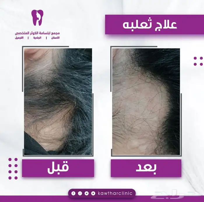 مصممة جرافيك - تسويق - ادارة حسابات 18