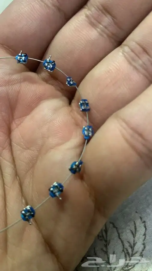 تقويم أسنان يا بلاشش    2