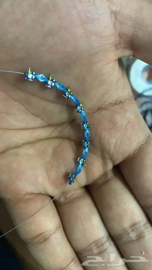 تقويم أسنان يا بلاشش    5