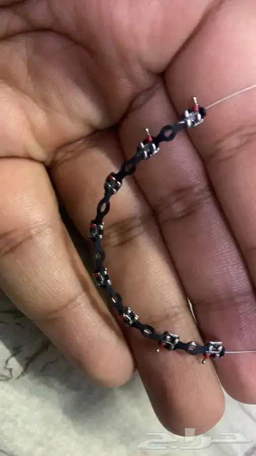 تقويم أسنان يا بلاشش    3