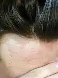 باروكه و شبكيه فرنسيه 6