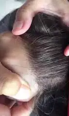 باروكه و شبكيه فرنسيه 8