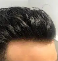 باروكه و شبكيه فرنسيه 7