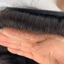 باروكه و شبكيه فرنسيه 0