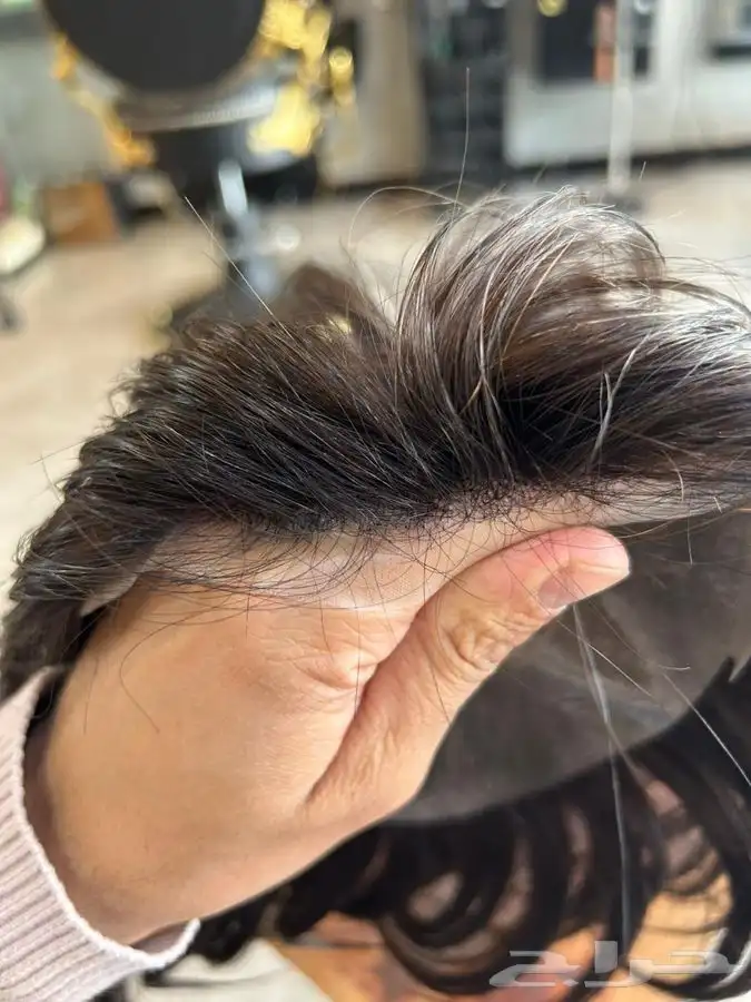 باروكه و شبكيه فرنسيه 4