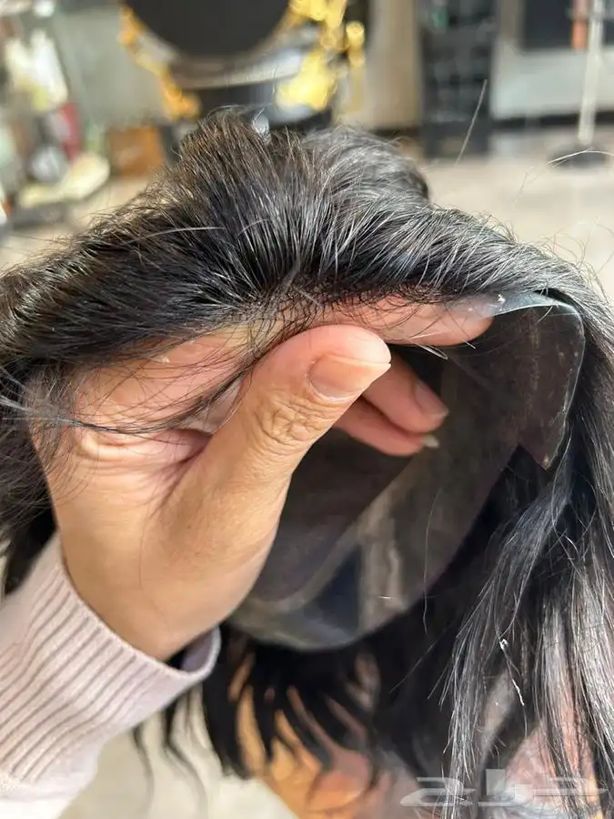 باروكه و شبكيه فرنسيه 3
