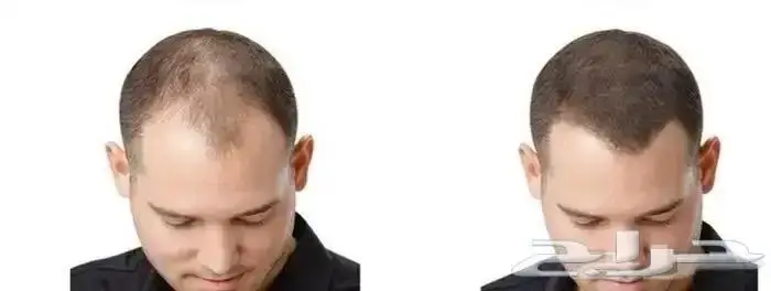 Toppik توبيك بودرة الشعر لعلاج الفراغات موقتا 3