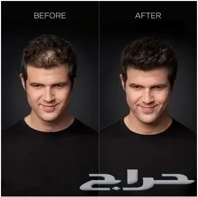 عرض اليوم الوطني 2 ب 120 ريال منتج توبيك لتغطيت الفراغات 0