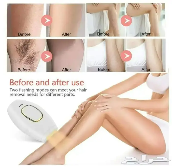 مزيل الشعر IPL جهاز الزالة الشعر 129 فقط 2