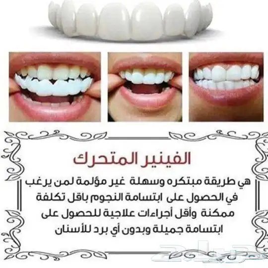 ابتسامة هوليود والتركيبات المتحركه 7
