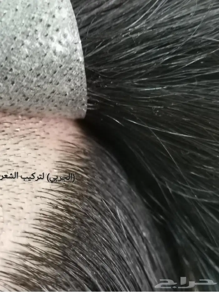 تركيب شعر طبيعي رجالي دائم بديل الزراعة 6