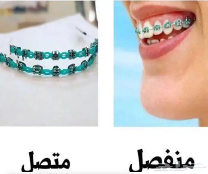 تقويم اسنان زينه 0