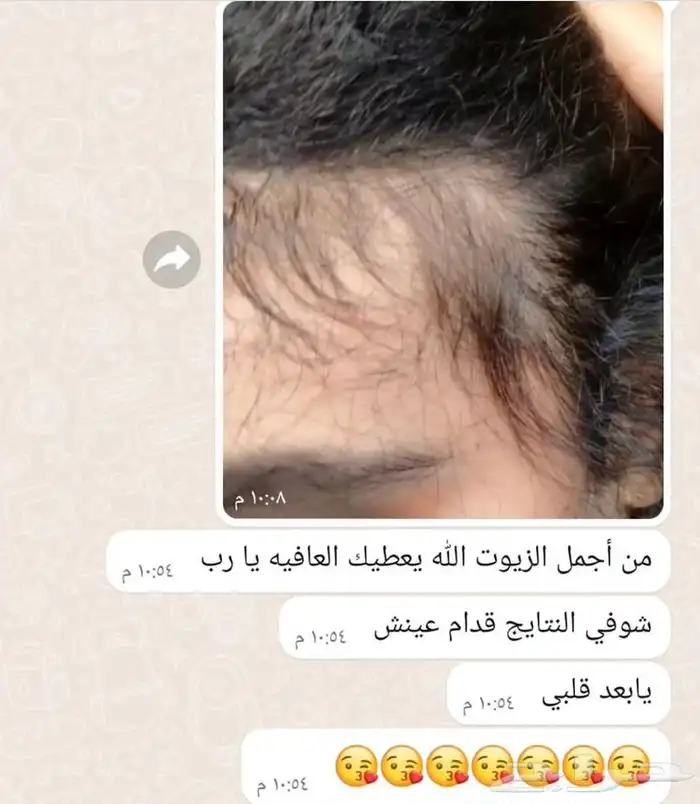 زيت شعر 8
