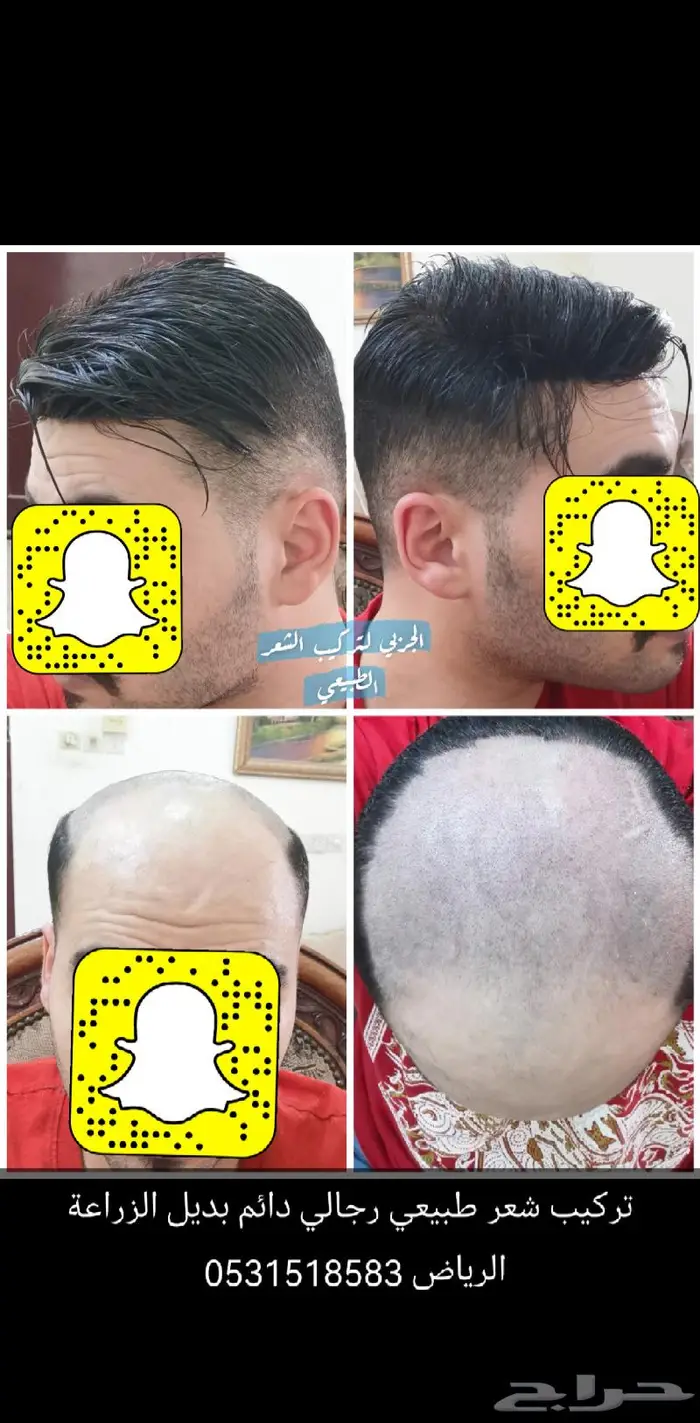 باروكة تركيب شعر طبيعي دائم 7