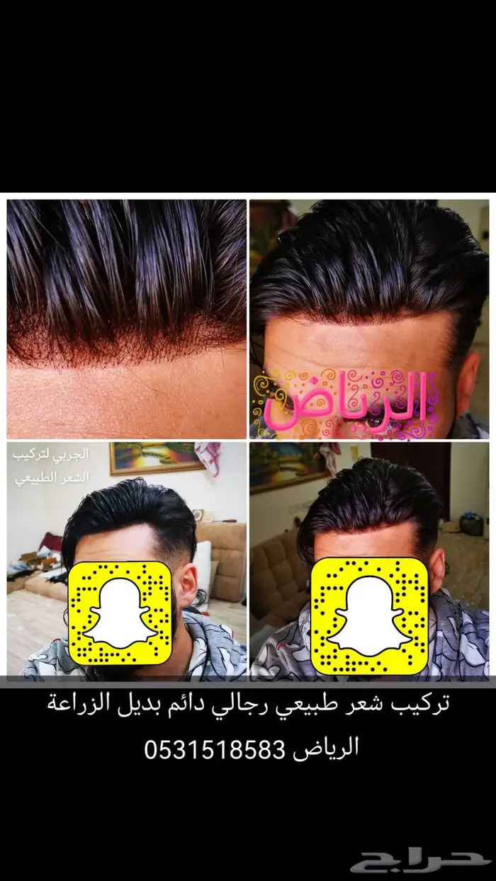 حل الصلع الافض والاعلى جودة 1