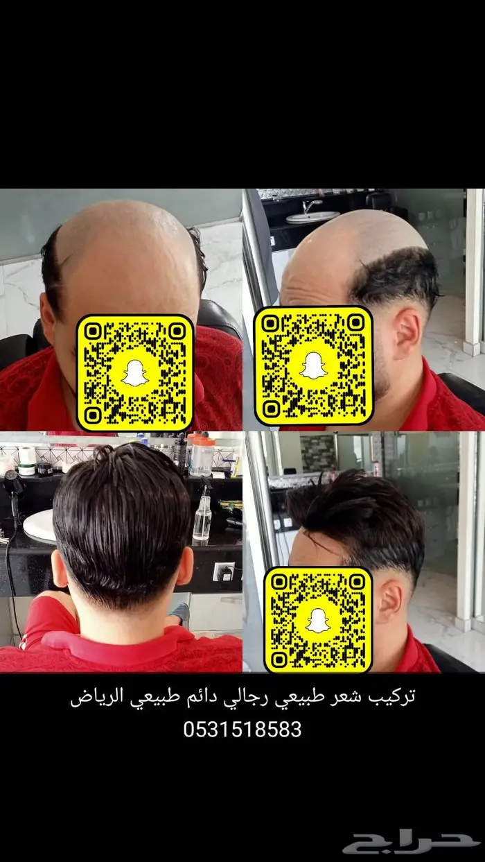 بوستيجة تركيب شعر طبيعي 0