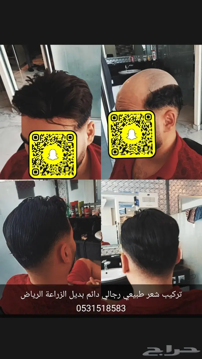 بوستيجة تركيب شعر طبيعي 1