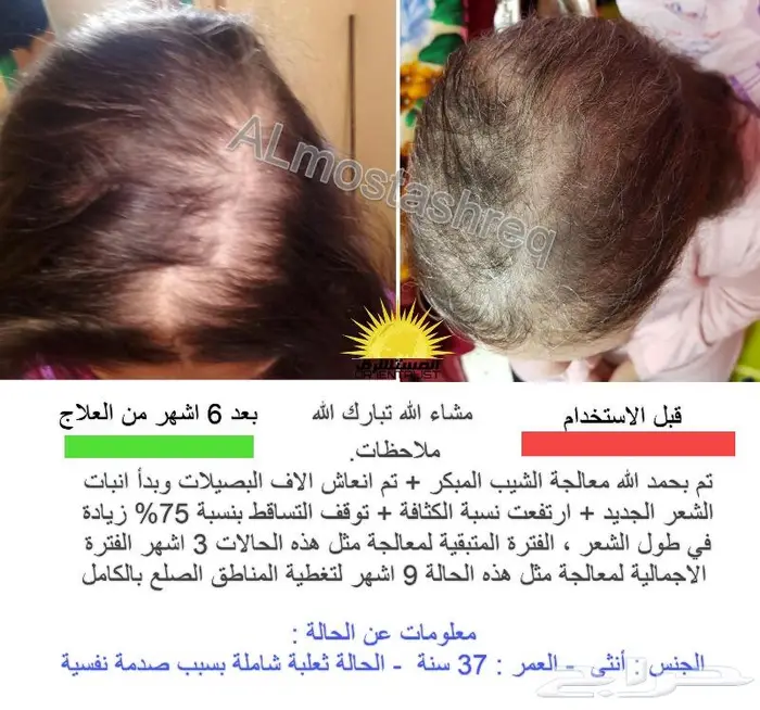شركة المستشرق للزيت الافغاني 48