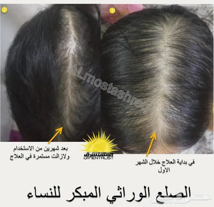 شركة المستشرق للزيت الافغاني 24