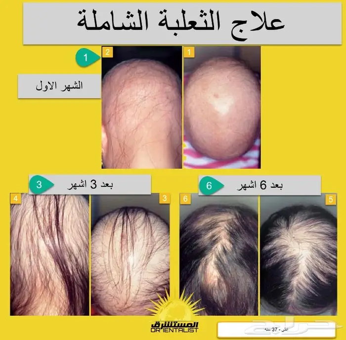 شركة المستشرق للزيت الافغاني 23