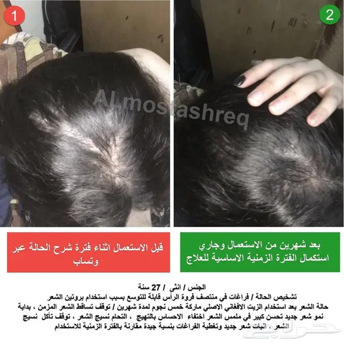 شركة المستشرق للزيت الافغاني 5