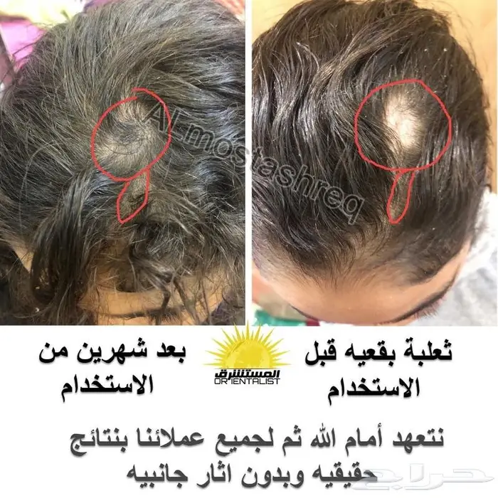 شركة المستشرق للزيت الافغاني 12