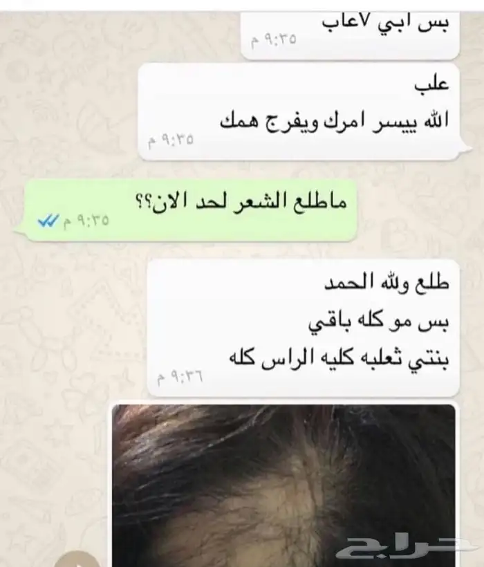 زيت الشعر لافغاني 8