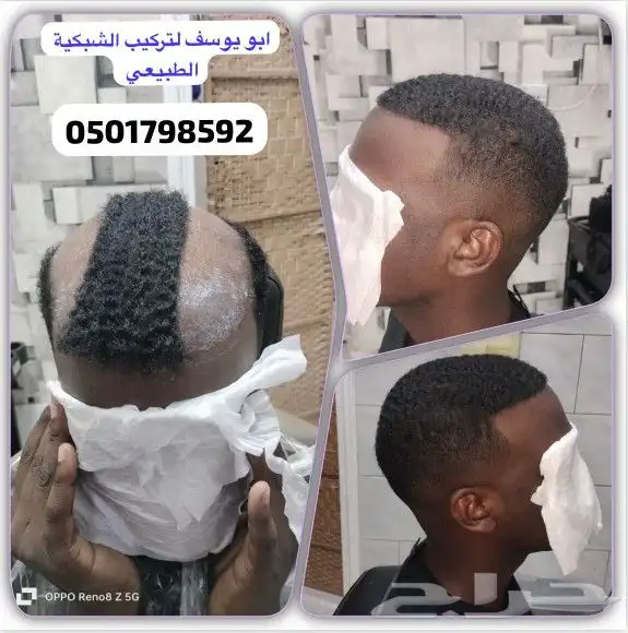 تركيب باروكات شعر رجالي طبيعي لزق وكليبسات بايدي مختص 0