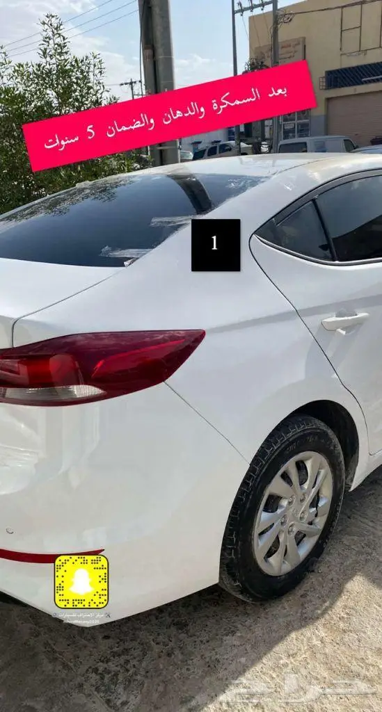 دهان التبهيت وتغير اللون الفحص الدوري يوجد تابي وتمارا 2