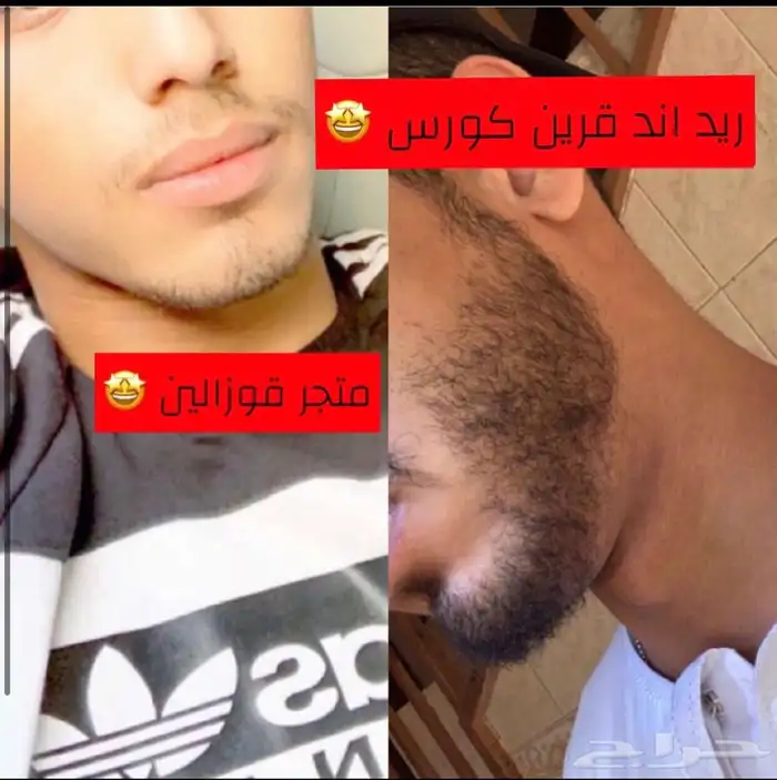 مفعول سحري زيت يساعد على انبات الشعر الدقن والراس 2