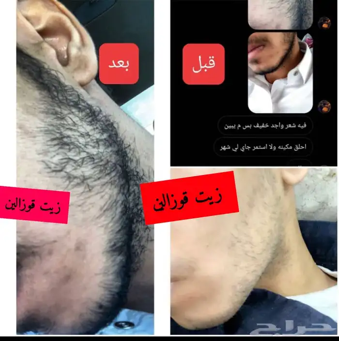 مفعول سحري زيت يساعد على انبات الشعر الدقن والراس 7