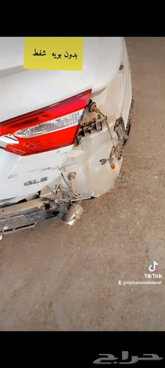 شفط وتعديل بدون بويه 9