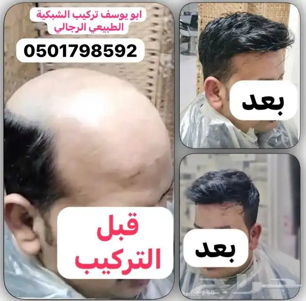 تركيب شعر طبيعي باروكه 1