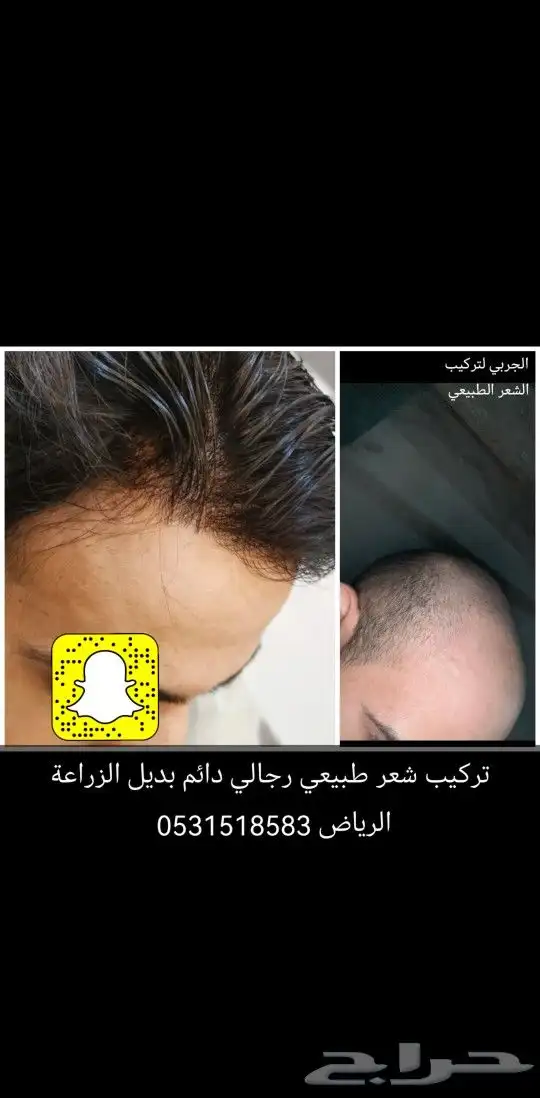 تركيب شعر طبيعي 1