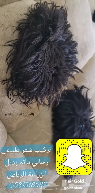 تركيب شعر طبيعي رجالي دائم بديل الزراعة 14